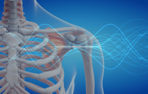 emf-pemf-effect-on-bone-health